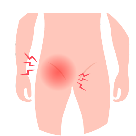mhsclinic-陰囊疼痛和腫塊