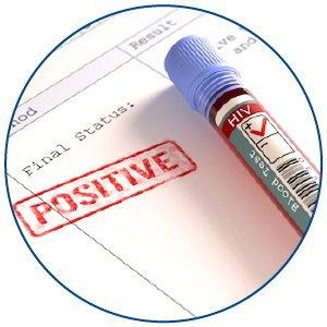 Genital Herpes test