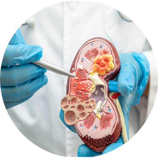 性前列腺、膀胱和泌尿系統_mhsclinic_Examples of Common Ailments in Men with Prostate, Bladder, and Urinary Symptoms01