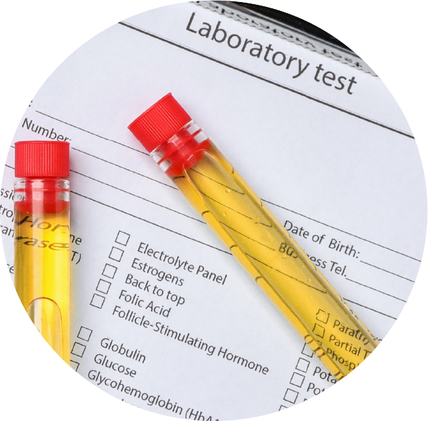 性前列腺、膀胱和泌尿系統_mhsclinic_urology_Lab_test_image