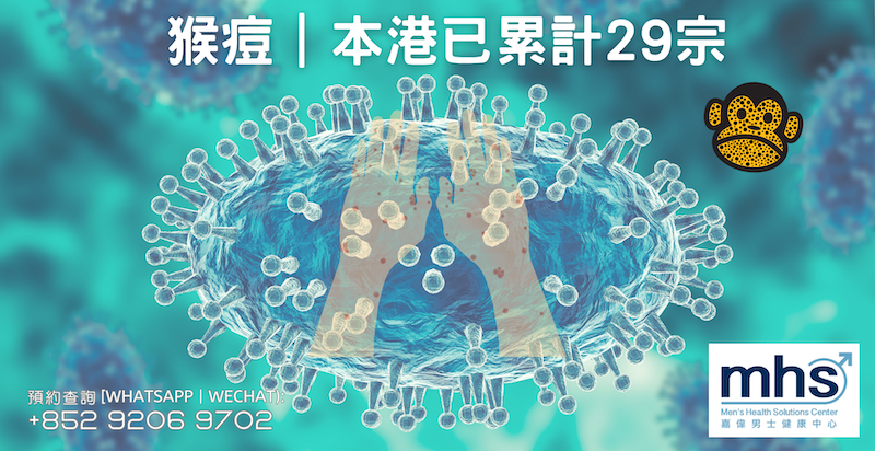 猴痘｜本港已累計29宗