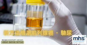 新方法檢測前列腺癌-驗尿