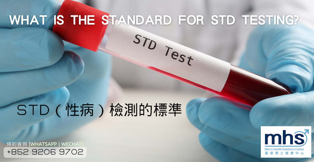 What is the standard for STD testing?