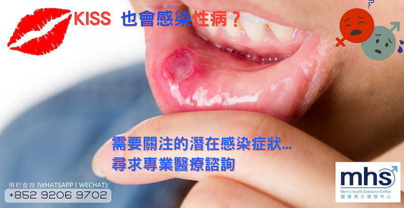 Kiss 也會感染性病？